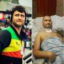 27-летний Антон Ермоленко до и после медицинской помощи, оказанной около полугода назад