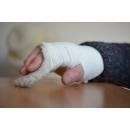 Девятилетняя девочка сломала палец в оздоровительном лагере в Бердске